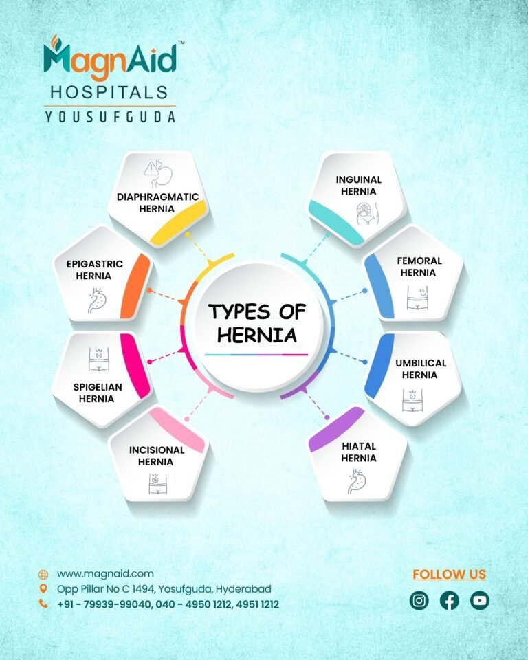 Hernia-treatment-in-Hyderabad Hernia-treatment-in-Hyderabad